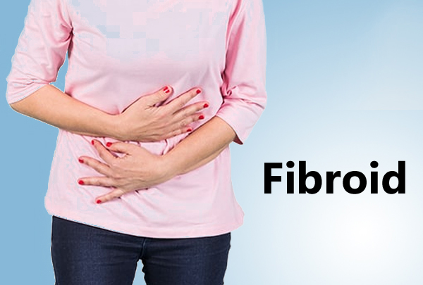 Fibroid Surgery