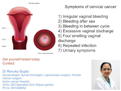 Cervical Cancer