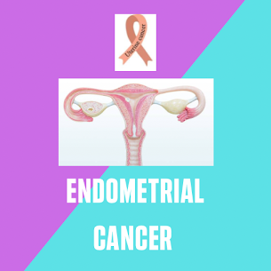 Endometrial Cancer