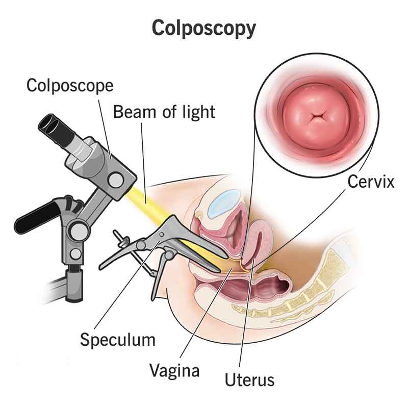 BEST DOCTOR FOR COLPOSCOPY