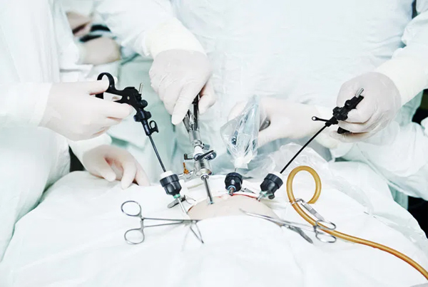 Best Laparoscopic Cancer Surgeon