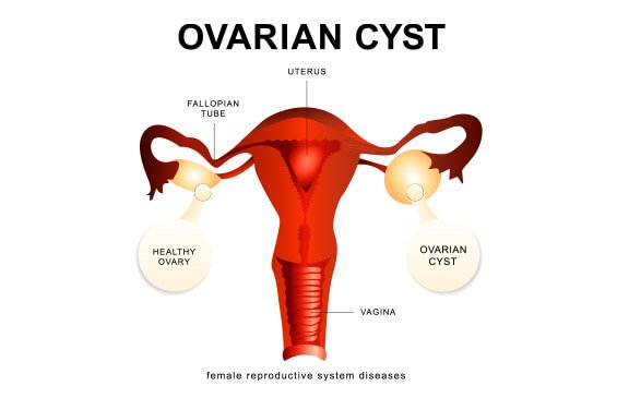 Best Ovary Specialist