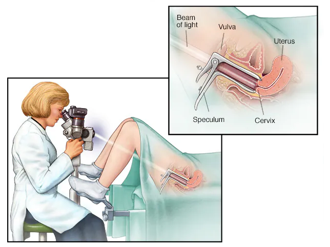 BEST DOCTOR FOR COLPOSCOPY